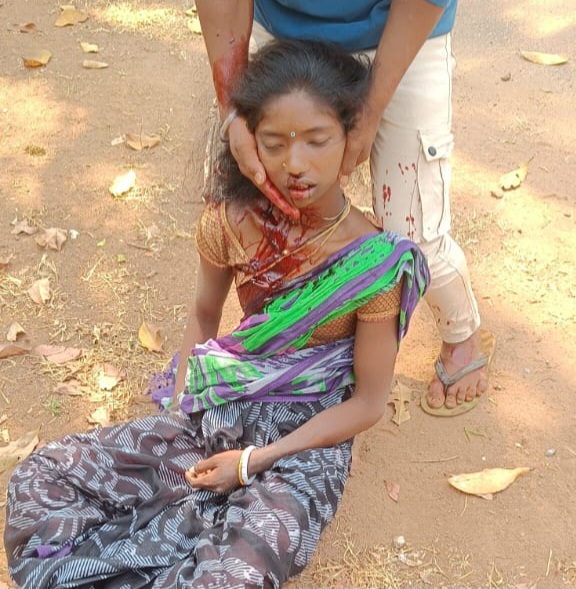 ଦୁଇ ବାଇକ୍ ମୁହାଁମୁହିଁ ଧକ୍କାରେ ଦୁଇ ଆହାତ। ଜଣେ ସଙ୍କଟାପନ୍ନ।